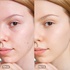 SKIN PERFECT WATERPROOF FOUNDATION SPF15