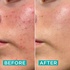 Clear Skin Balancing & Moisturizing Cream