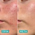 Clear Skin Foaming Gel Cleanser