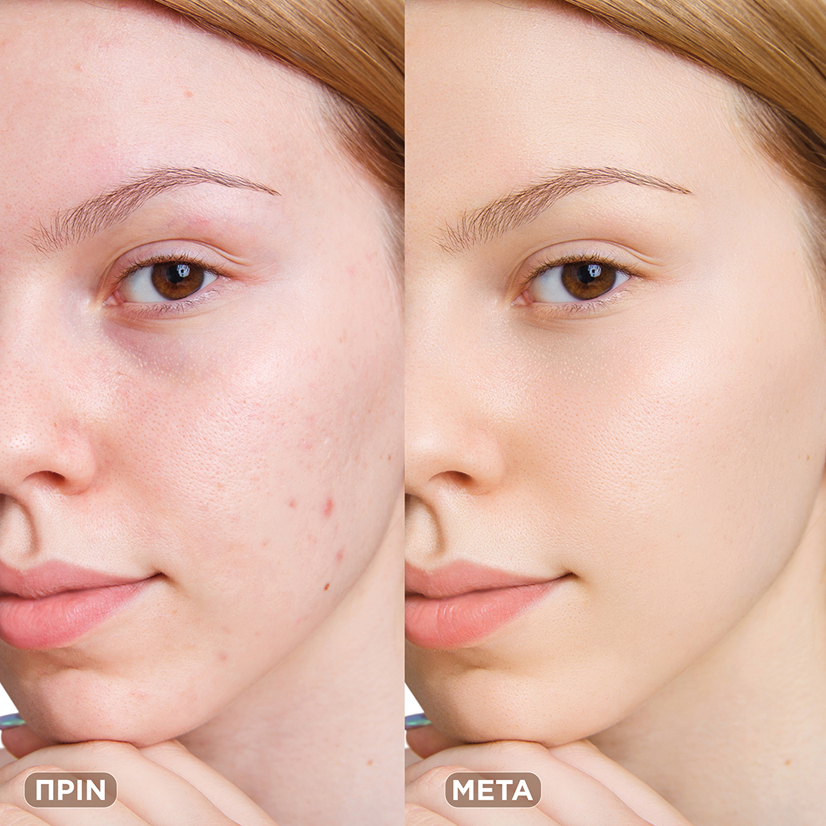 SKIN PERFECT WATERPROOF FOUNDATION SPF15